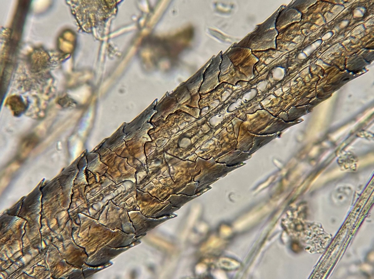 Microscopic View of a Subject - 1